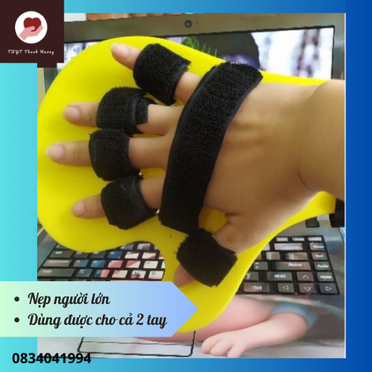 Nẹp cố định bàn ngón tay