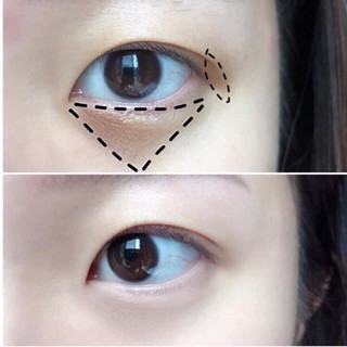 Serum mắt estee lauder ANR eye Matrix 5ml