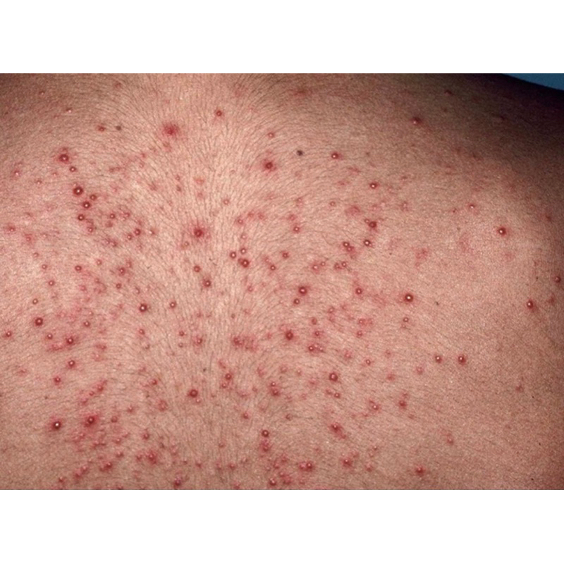 KELA LOTION vıêm LỖ châŋ LÔNG THÁI LAN 60ML ..