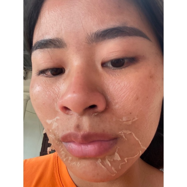 Siêu Vi Kim Thảo Dược . Vi Kim Thảo Mộc