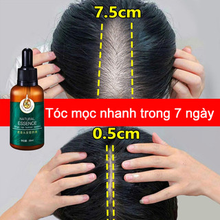 Thuốc mọc tóc tinh dầu mọc tóc kích thích mọc tóc chăm sóc tóc chống rụng tóc kích thích tóc mọc dà 30ml