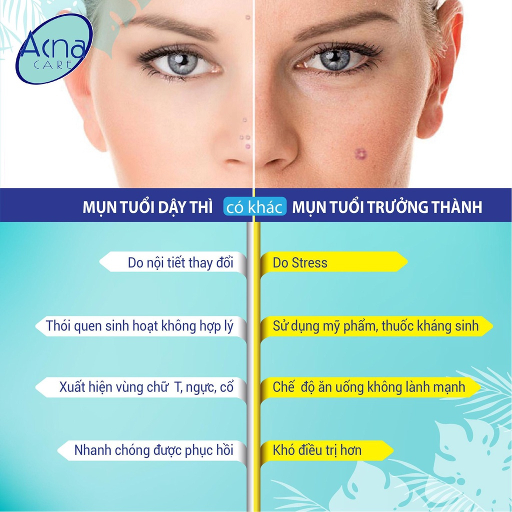 Viên uống, gel Acnacare  giảm tiết bã nhờn da dầu, ngăn mụn, chống oxy hóa