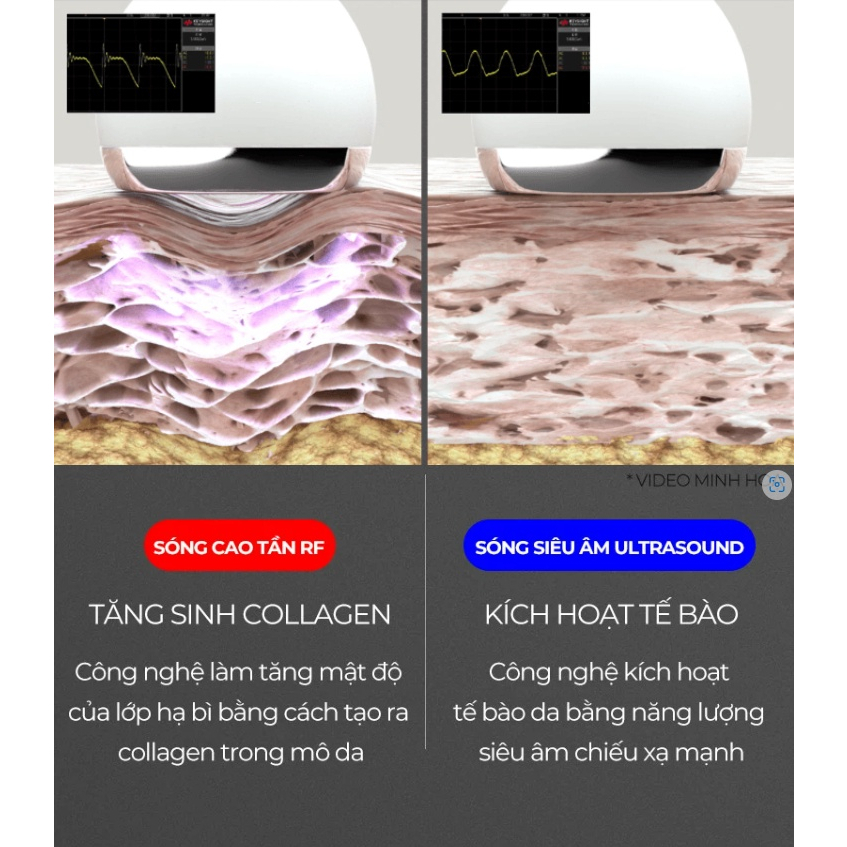 Thiết Bị Tăng Sinh Collagen Medicube AGE-R USSERA DEEP SHOT