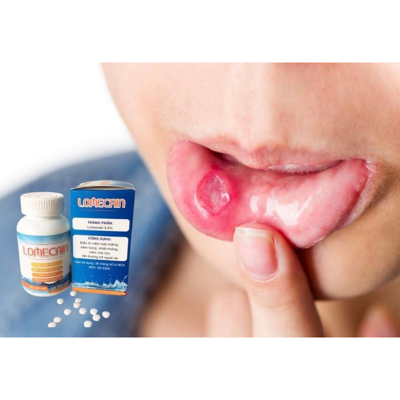 Nhiệt Bạch Mai Lomecain Lọ 500 Viên