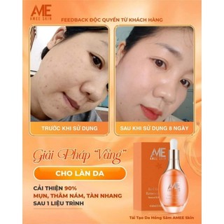 (Peel Da) TÁI TẠO HỒNG SÂM AMEE-SKIN