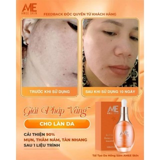 (Peel Da) TÁI TẠO HỒNG SÂM AMEE-SKIN