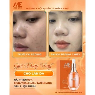 (Peel Da) TÁI TẠO HỒNG SÂM AMEE-SKIN