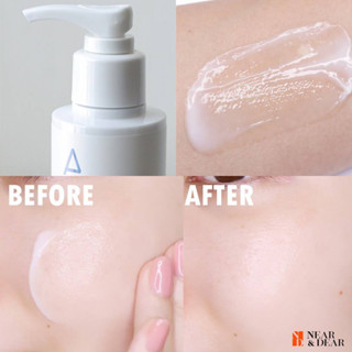 Kem dưỡng Lotion Aestura dưỡng ẩm phục hồi làm sáng da ATOBARRIER 365 LOTION sữa dưỡng 150ml