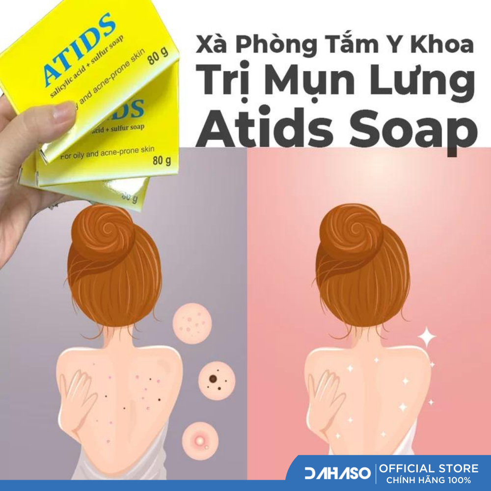 Xà phòng tắm Atids - dành cho da cơ địa, viêm da - Dahaso Skin