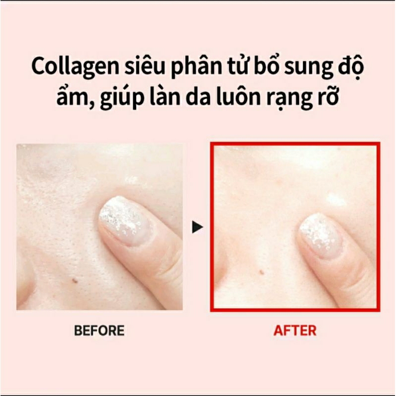 Mặt nạ MEDIPEEL Lacto Collagen dạng lột giúp da căng bóng, mịn màng