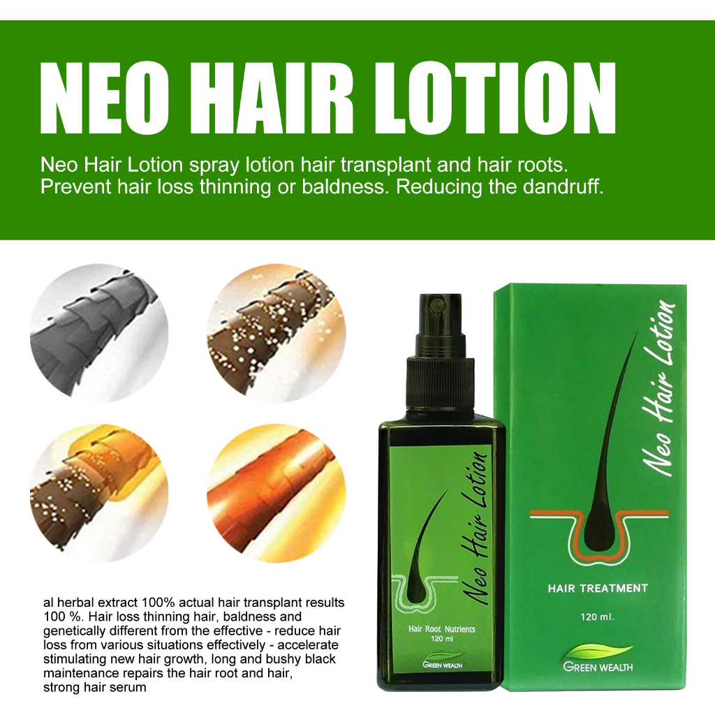 Tinh chất mọc tóc NEO HAIR LOTION, serum kích thích mọc tóc, xịt tóc Neo Hair giảm hói đầu, chống gãy rụng 120ml