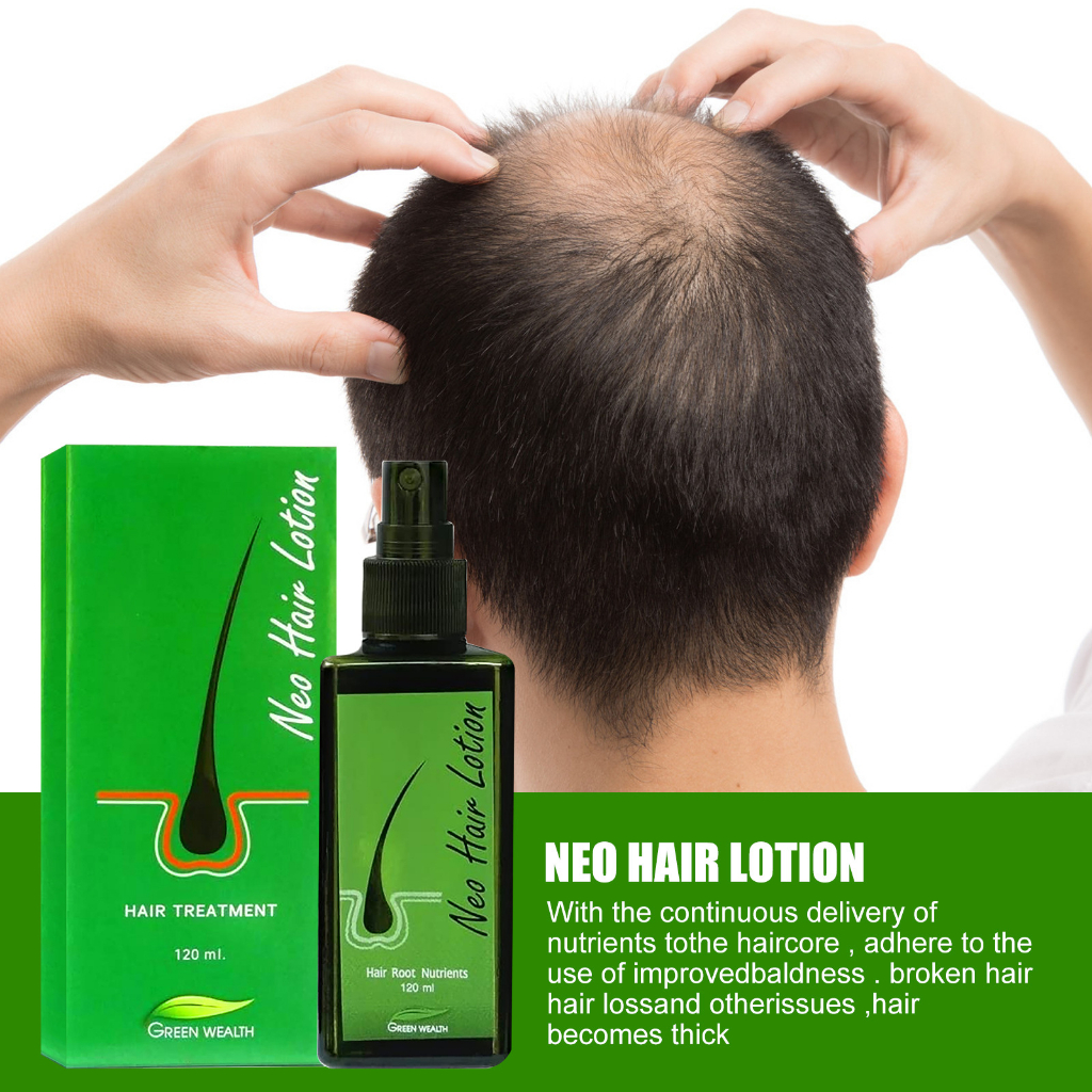 Tinh chất mọc tóc NEO HAIR LOTION, serum kích thích mọc tóc, xịt tóc Neo Hair giảm hói đầu, chống gãy rụng 120ml