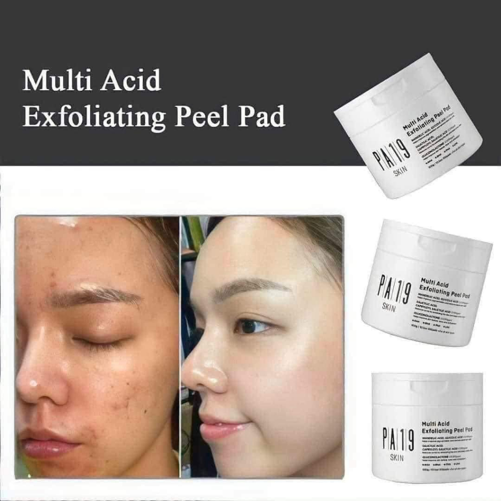 Toner Pad Tẩy Da Chết PA19 hộp 100m