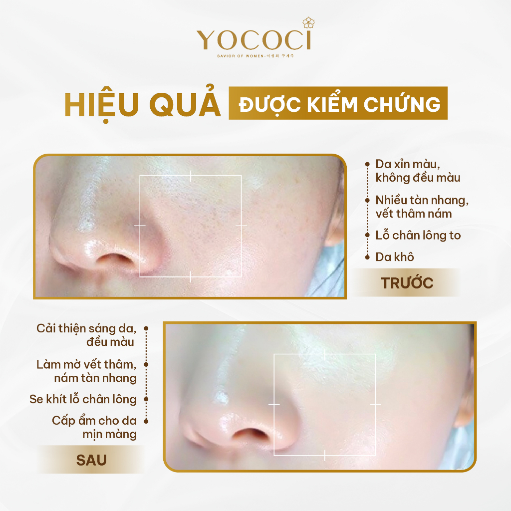 Kem dưỡng trắng da mặt ngày đêm cao cấp Yococi White Perfect Face Cream Day Night  trắng hồng tự nhên 20g