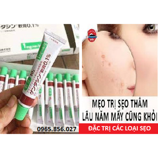 ⭐ chính hãng ⭐ kem 𝘁𝗿𝗶̣ 𝘀𝗲̣𝗼 - 𝘁𝗿𝗶̣ 𝘁𝗵𝗮̂𝗺 𝗻𝗵𝗮̣̂𝘁 𝗯𝗮̉𝗻