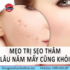 ⭐ CHÍNH HÃNG ⭐ Kem 𝘁𝗿𝗶̣ 𝘀𝗲̣𝗼 - 𝘁𝗿𝗶̣ 𝘁𝗵𝗮̂𝗺 𝗻𝗵𝗮̣̂𝘁 𝗯𝗮̉𝗻
