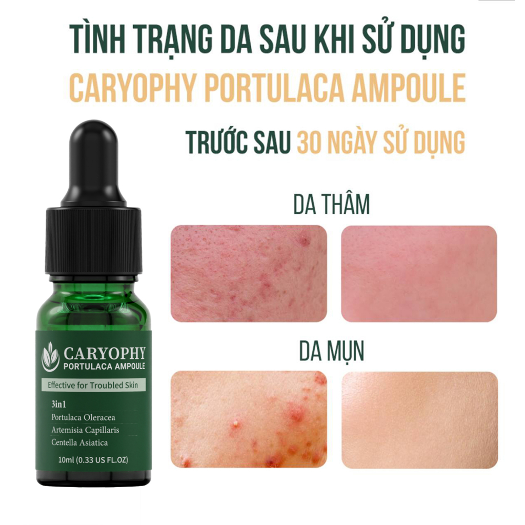 Bộ chăm sóc da giảm mụn mờ thâm Caryophy Portulaca Hàn Quốc