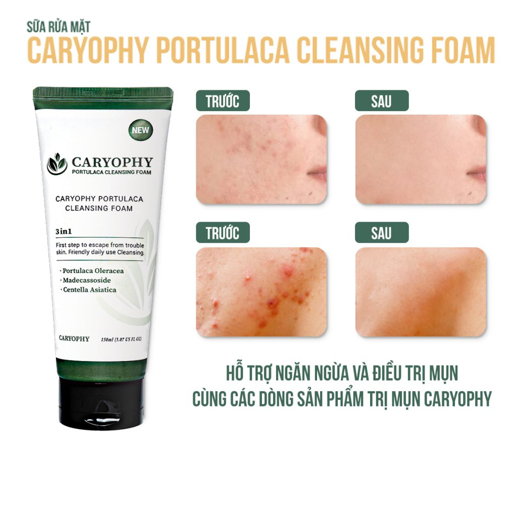 Bộ chăm sóc da giảm mụn mờ thâm Caryophy Portulaca Hàn Quốc