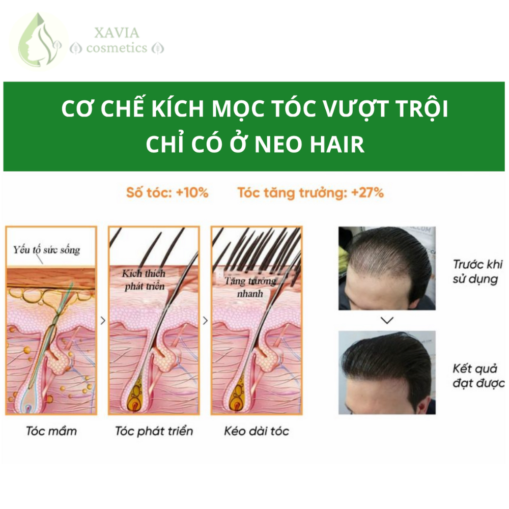 Tinh chất kích thích mọc tóc NEO HAIR LOTION, kích mọc tóc Nhanh - Khỏe - An toàn, Dung tích 120ml - XAVIA COSMETICS