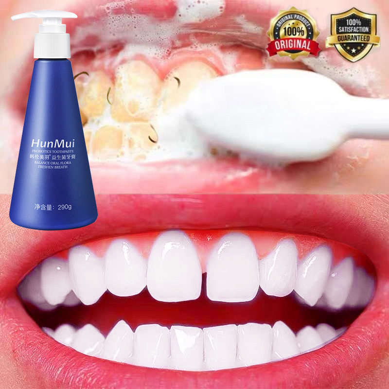 Kem Đánh Răng Làm Trắng Răng Giúp Làm Trắng Nhanh Chóng,Hiệu Quả Hỗ trợ loại bỏ 93 % Cao răng Backing Soda 290g