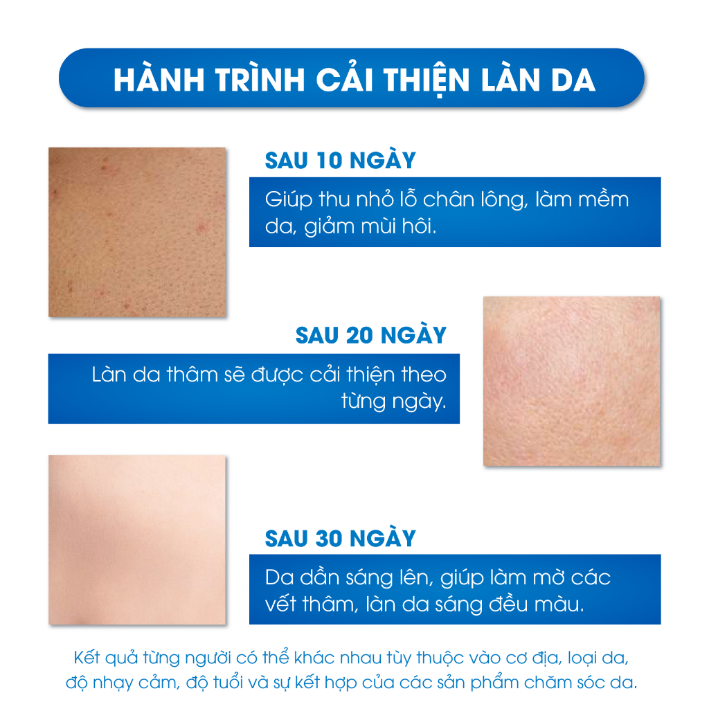 Serum Mờ Thâm Nách, Mông, Thâm Đầu Gối, Khuỷu Tay, Khử Mùi Vùng Nách Oriskin Sakina White Serum 30ml