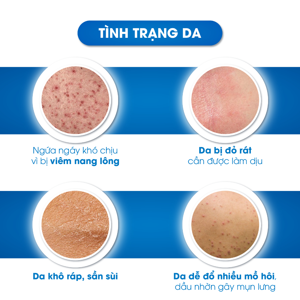 Sữa Tắm Hỗ Trợ Ngăn Ngừa Mụn, Viêm Nang Lông, Làm Sạch Sâu Bụi Bẩn, Dành Cho Nam Oriskin Puri shower Gel 300ml