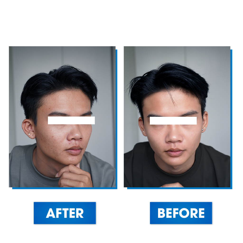 Serum Mờ Thâm Trắng Da Kiềm Dầu Se Khít Lỗ Chân Lông Oriskin O’vita Light Serum 20ml