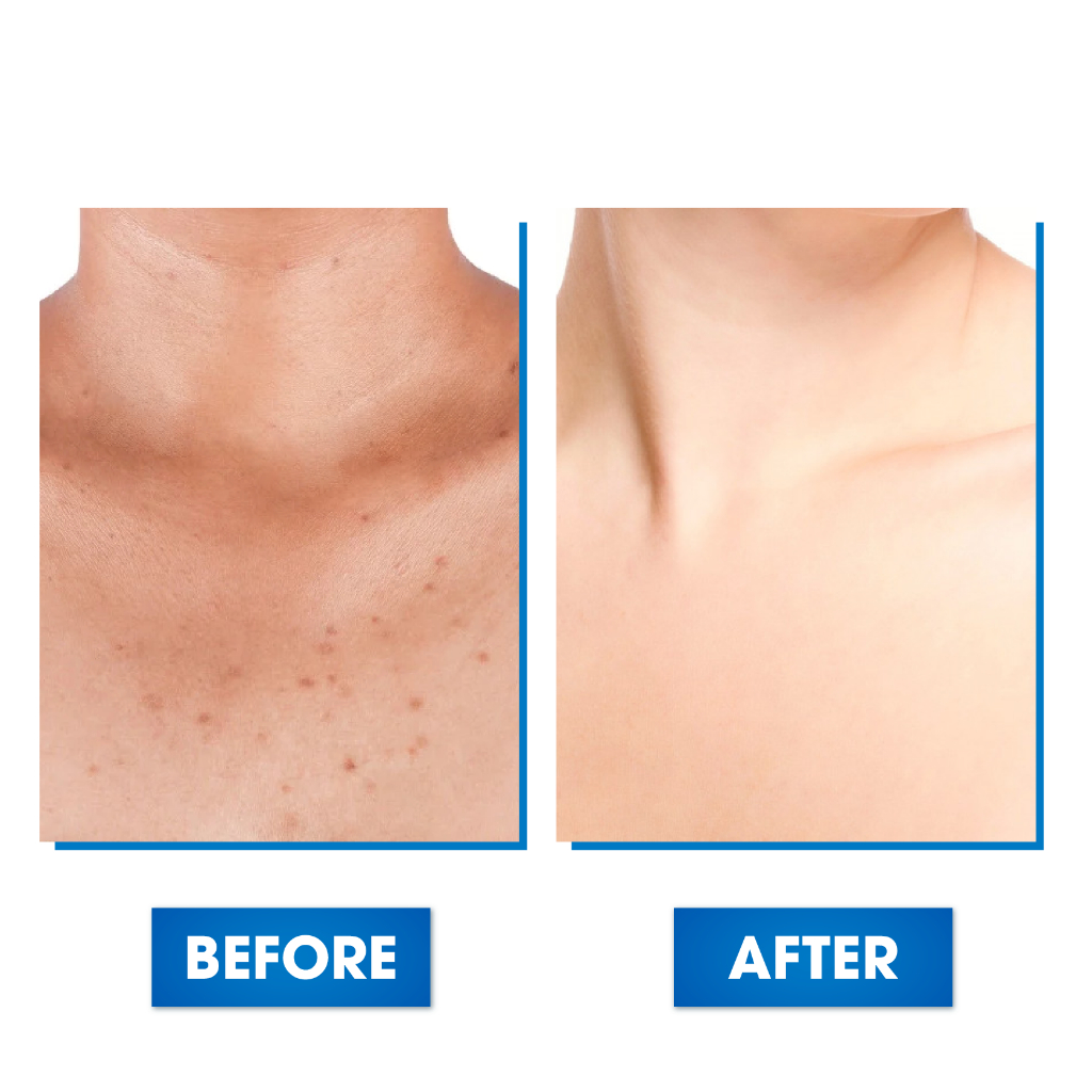 Serum Mờ Thâm Nách, Mông, Thâm Đầu Gối, Khuỷu Tay, Khử Mùi Vùng Nách Oriskin Sakina White Serum 30ml