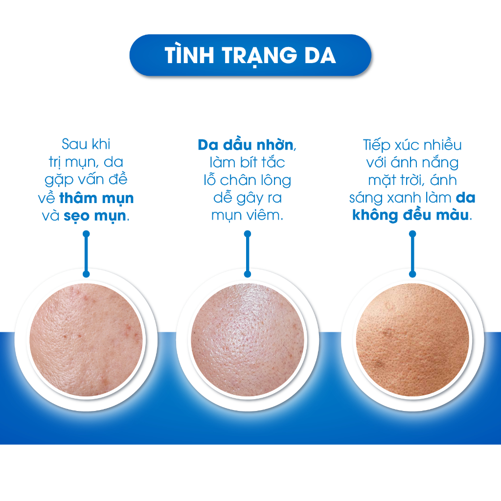 Serum Mờ Thâm Trắng Da Kiềm Dầu Se Khít Lỗ Chân Lông Oriskin O’vita Light Serum 20ml
