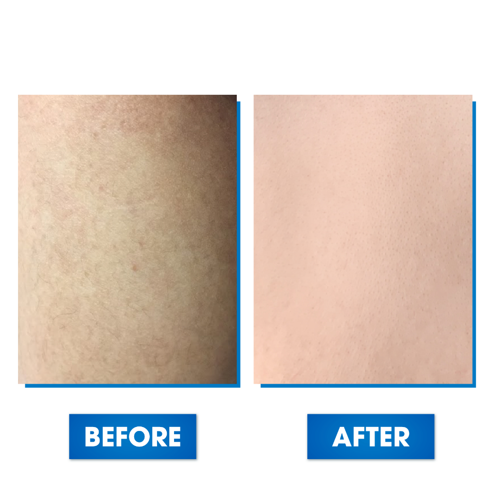 Kem Dưỡng Trắng Da O'riday Body Cream, Dưỡng Trắng Da Toàn Thân, Chống Nắng Cấp Ẩm Da Body 200ml