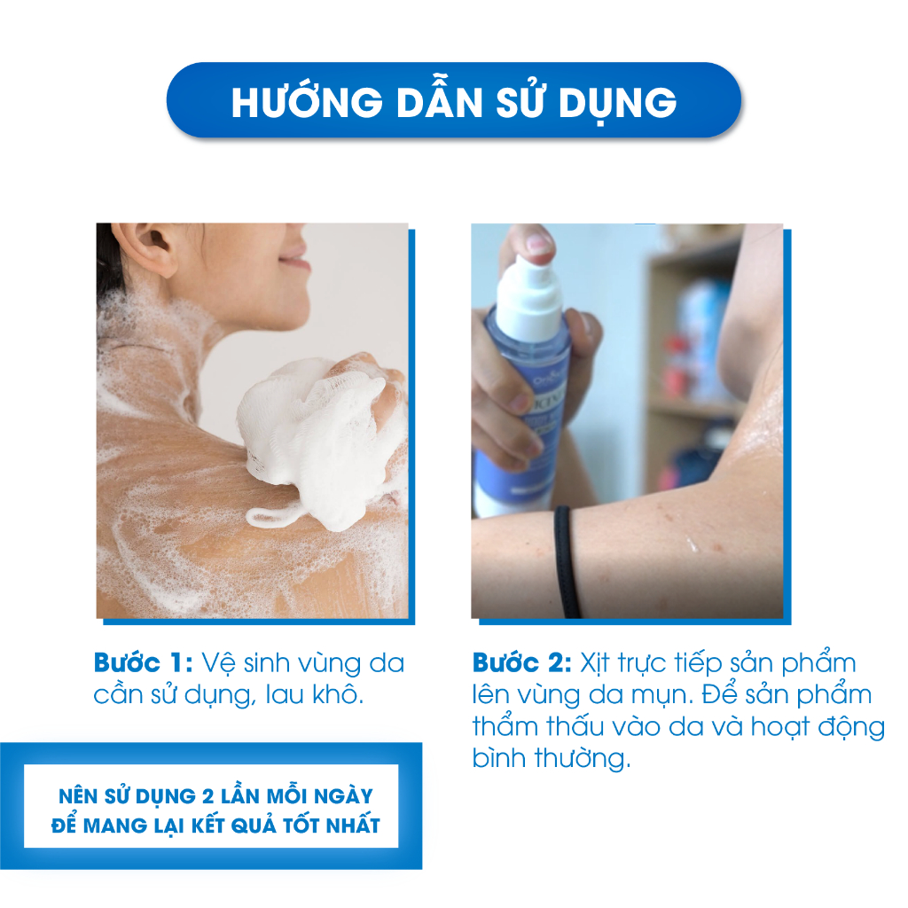 Xịt Mụn Lưng , Ngực , Giảm Mụn Sưng , Mụn Viêm , Mụn Trứng Cá , Giảm Viêm Nang Lông Nữ  Oriskin Vicenta Body Mist  100ml