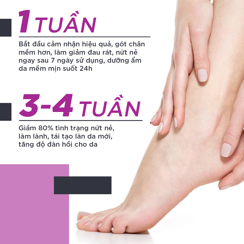 Combo 2 Kem Dưỡng Ẩm Làm Mềm Gót Chân Oriss Dưỡng Da Gót Chân Giảm Đau Làm Liền Vết Nứt - 30g/tuýp