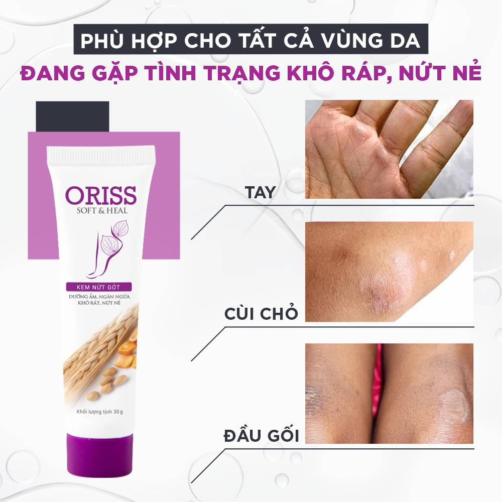 Combo 2 Kem Dưỡng Ẩm Làm Mềm Gót Chân Oriss Dưỡng Da Gót Chân Giảm Đau Làm Liền Vết Nứt - 30g/tuýp