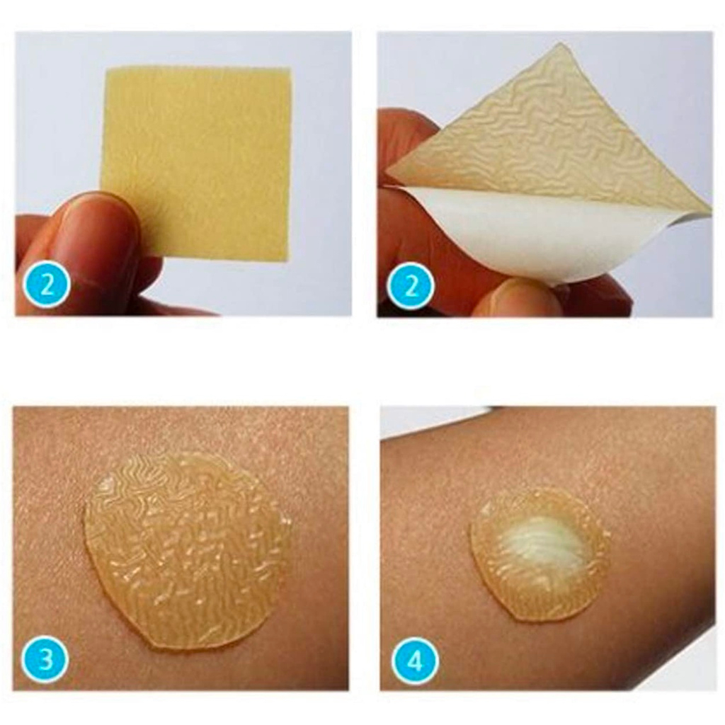 Combo 3 miếng dán mụn, băng dán vết thương Duoderm 10x10cm chứa hydrocolloid giảm thâm sẹo
