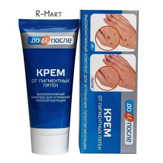 Kem xoá đồi mồi tay Kpem của Nga