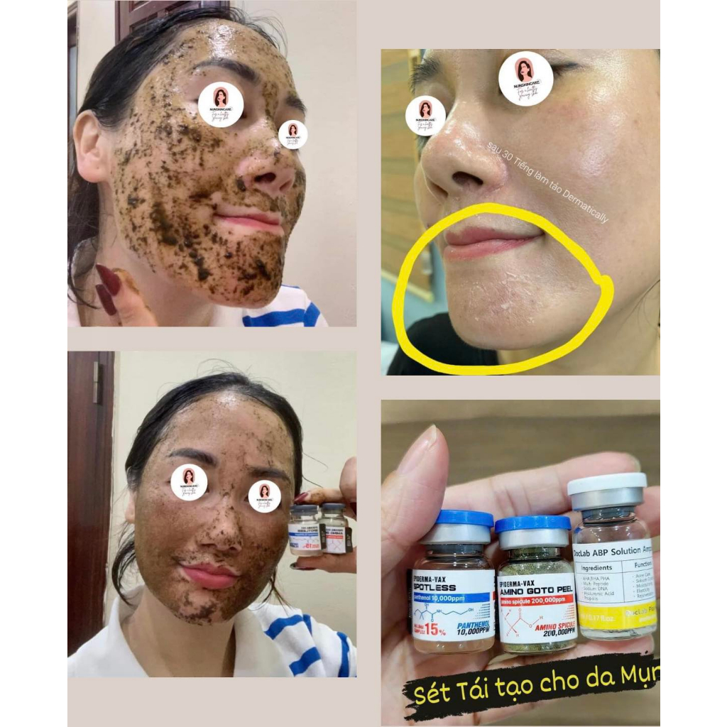 Vi tảo bong Dermatically Epiderma Vax Amino Goto Peel - Út store