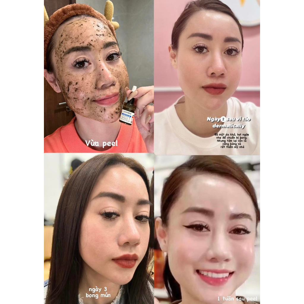 Vi tảo bong Dermatically Epiderma Vax Amino Goto Peel - Út store