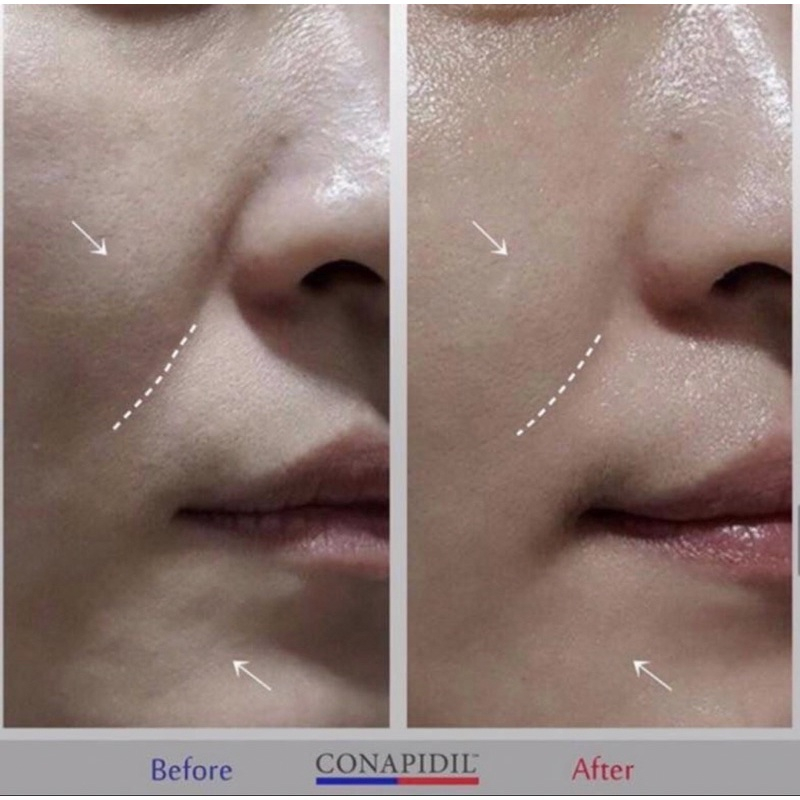 Kem tái định vị da Cemenzal. Kem đêm chuyên sâu chống lão hóa, giảm kích ứng