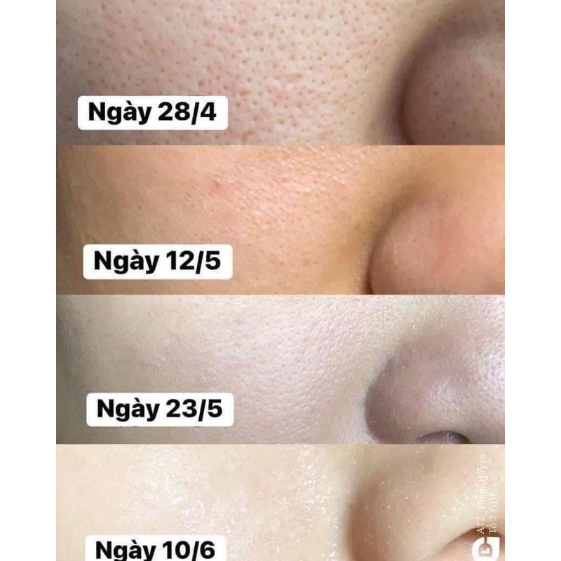 Dung dịch BHA 148ml bill US