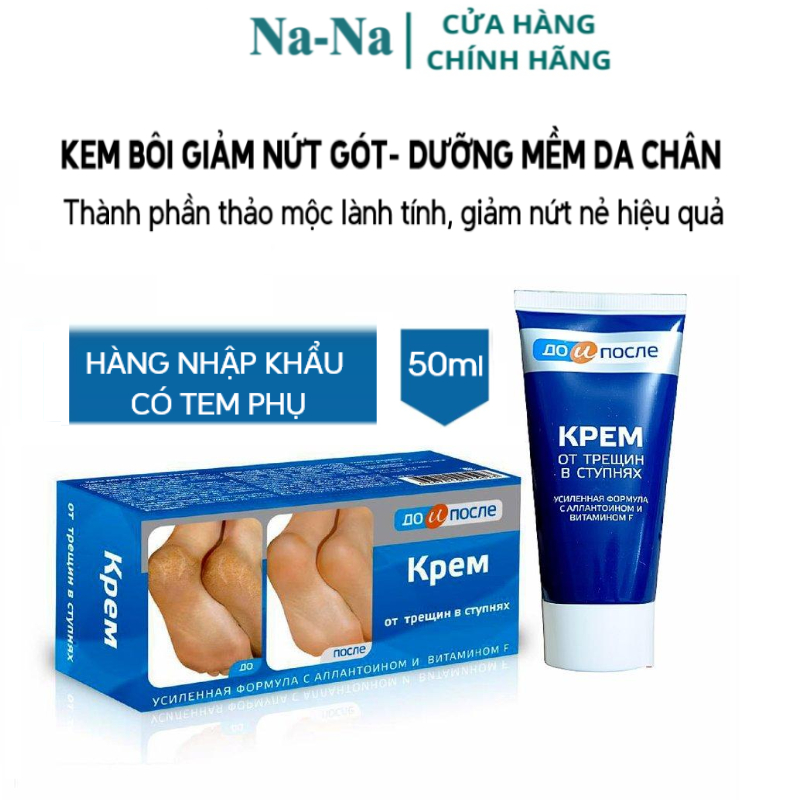 Kem dưỡng giảm nứt gót, dưỡng mềm da gót chân Kpem 50g Sản phẩm: Kem bôi giảm nứt gót chân - 50G