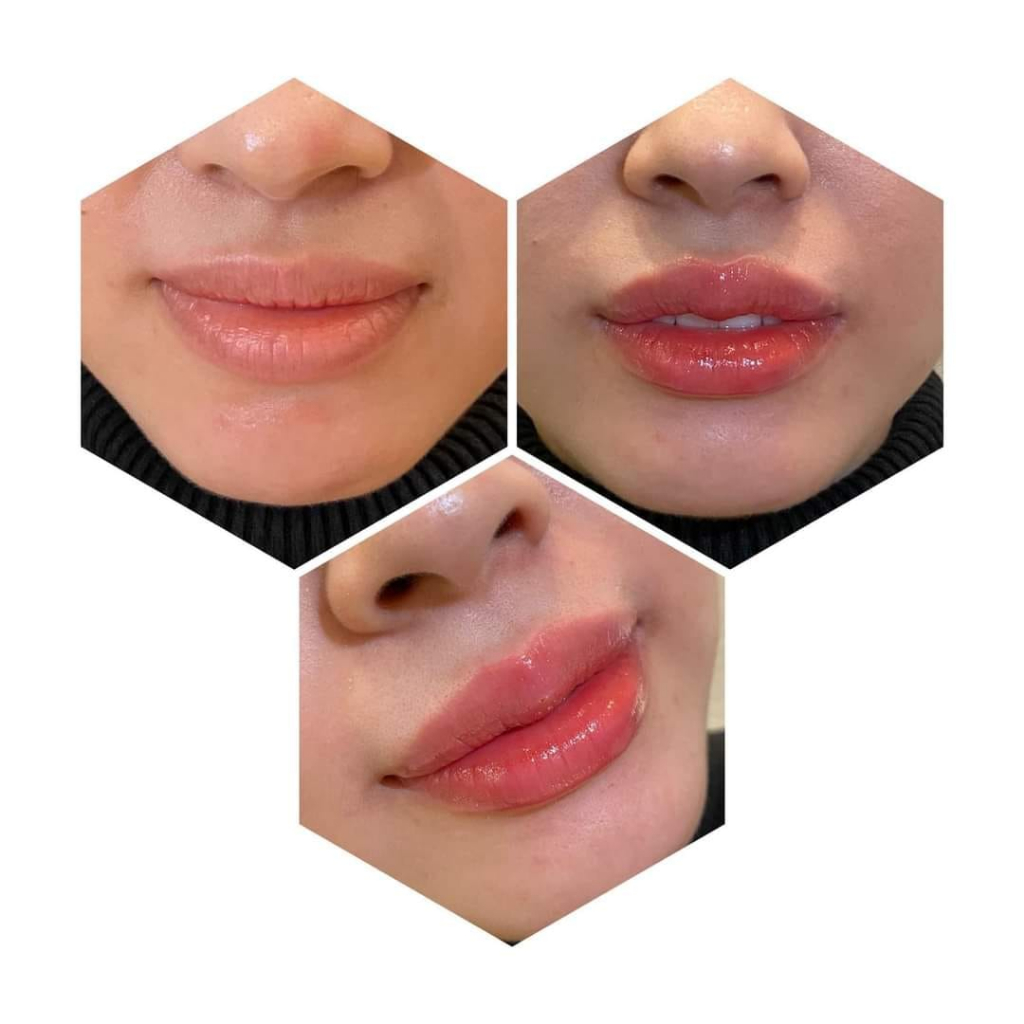 Dưỡng Kích Màu Môi MT collagen sau xăm dưỡng bóng hồng môi tự nhiên+Tặng nước hoa