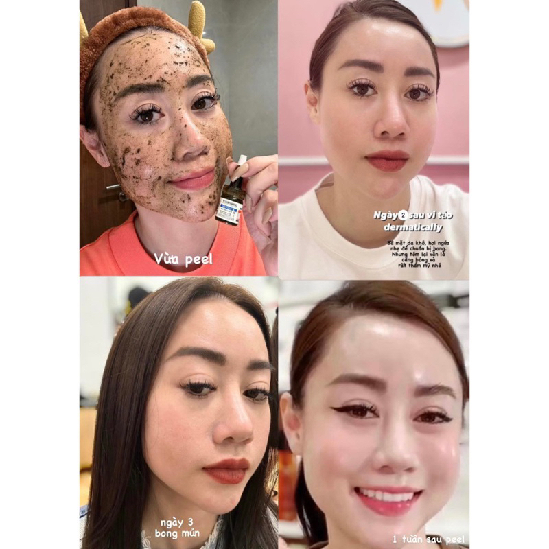 Peel da Vi tảo bong Dermatically Epiderma Vax Amino Goto Peel - hanabeauty88