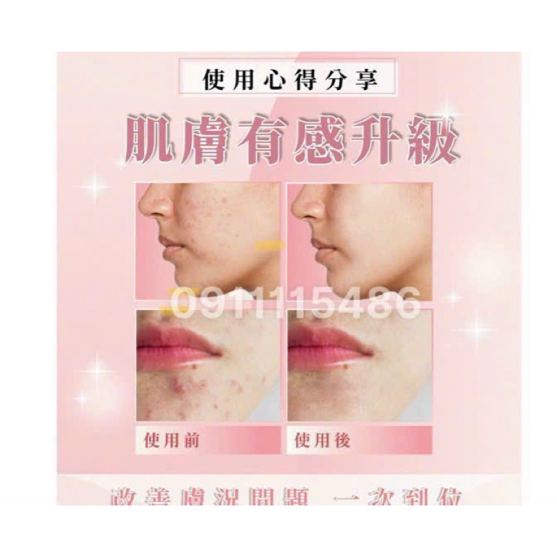 Combo Lyna và Hoa lan làm đẹp da Auth 🇺🇸