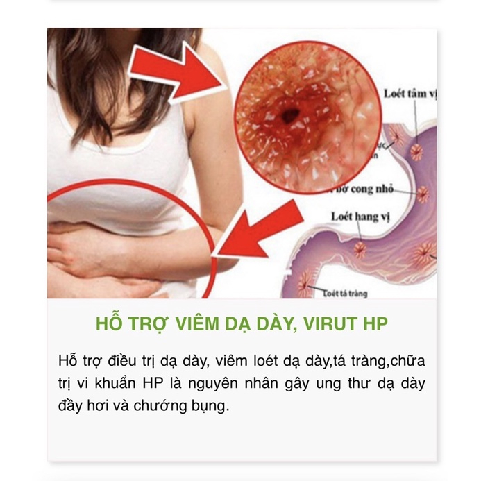 Chè Dây Hoàng Gia Phiên Bản Mới 300g - Hỗ Trợ Đau Dạ Dày Khuẩn HP Giảm Ợ Hơi Ợ Chua