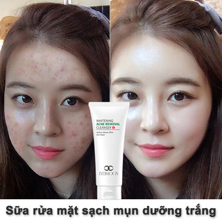 Sữa rửa mặt cho da dầu mụn sữa rửa mặt mụn sạch sâu trắng da lydimoon chống khuẩn diệt mạt kiềm dầu làm sạch 100g