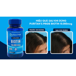 Viên uống giúp mọc tóc, giảm rụng tóc Puritan s Pride Ultra Mega Biotin