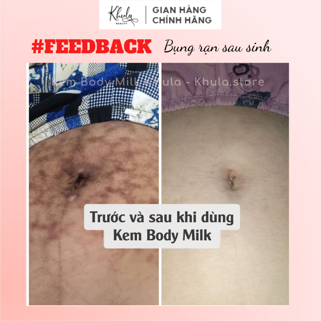 1KG Kem body dưỡng trắng da K'hula Milk, Dòng dưỡng trắng chuyên sâu dưỡng da trắng hồng tự nhiên không nhờn rít - KHULA