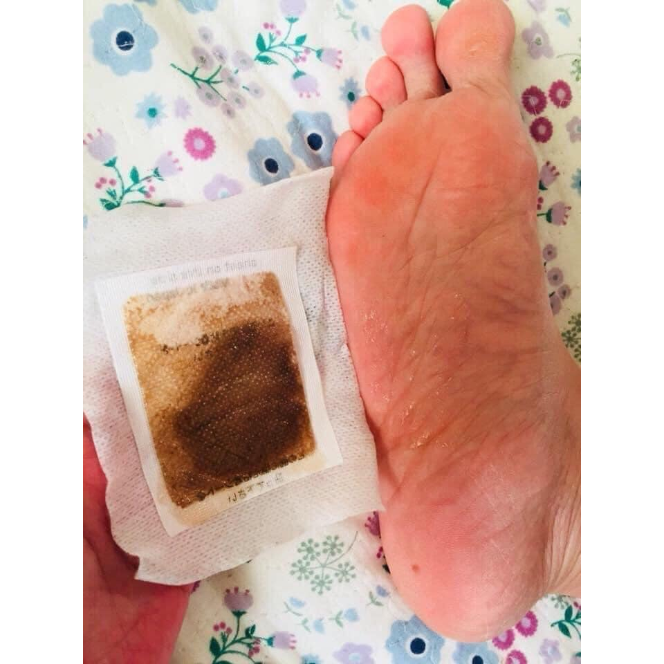 Miếng Dán Thải Độc KenKo 36 Miếng Nhật Bản