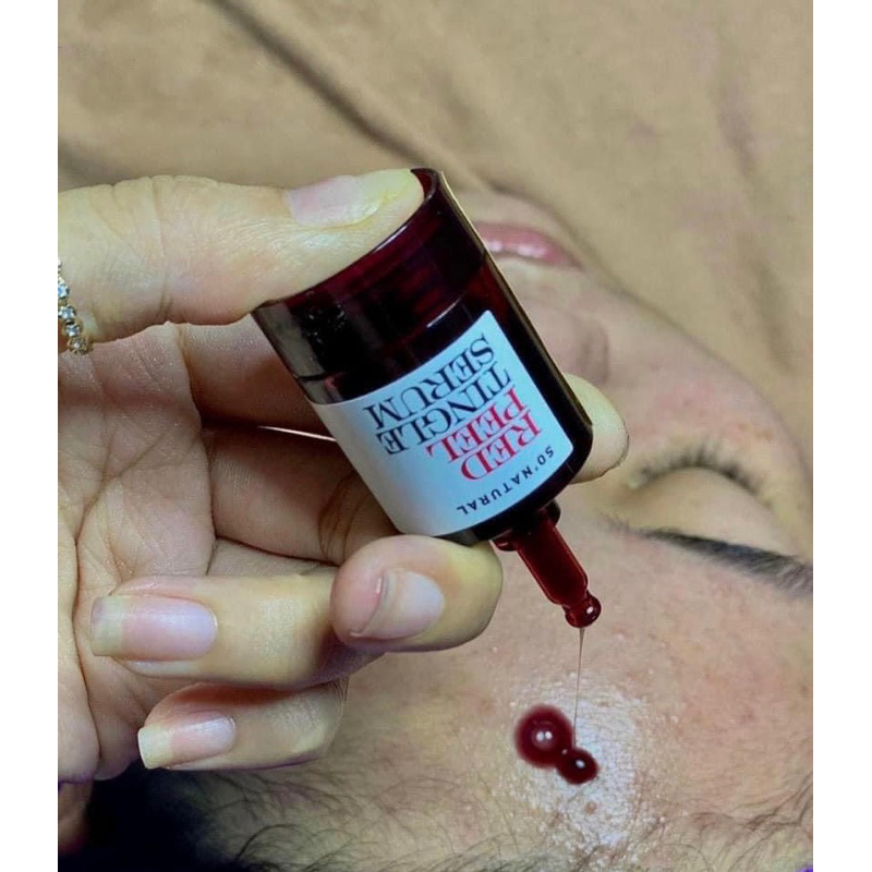 Thay Da Sinh Học Red Peel Tingle Serum So Natural Tẩy Da Chết Làm Sáng Mờ Thâm Tái Tạo Da Giảm Mụn