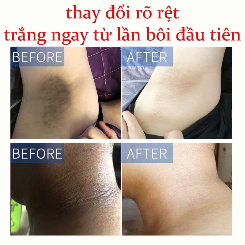 Kem Trắng Da Toàn Thân Giúp Giảm Thâm Nách, Mông, Đầu Gối, Khuỷu Tay 50g